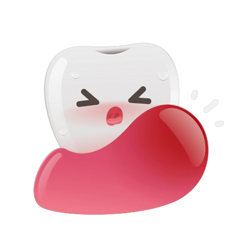 Laser Gum Depigmentation - Gum Bleaching