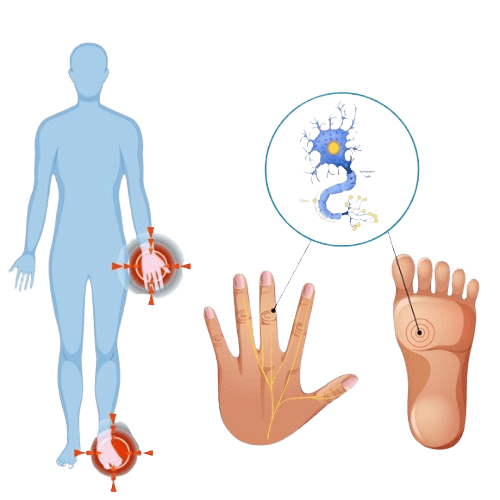 Neuropathy- Stem Cell