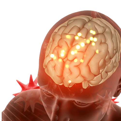 Parkinsons Disease- Stem Cell