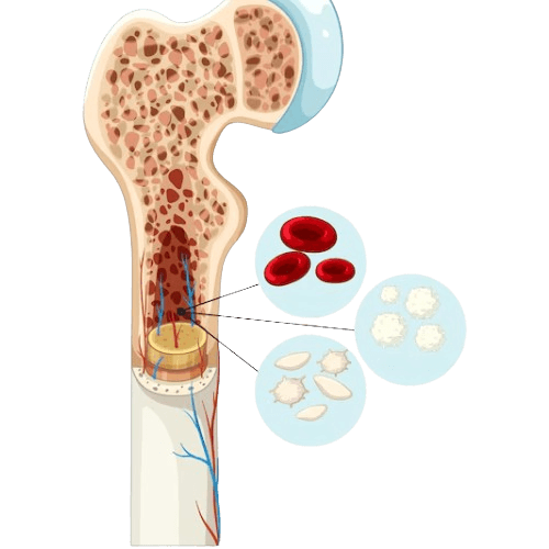 Autologous Bone Marrow Transplant