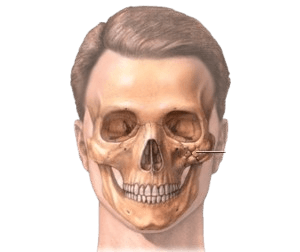 Craniofacial Reconstruction Surgery
