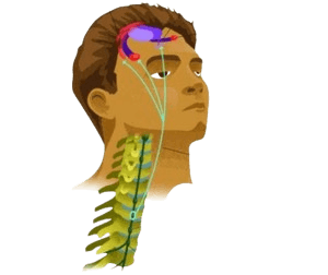 Neurolysis Procedure