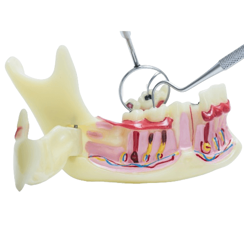 Tooth Reshaping & Dental Contouring