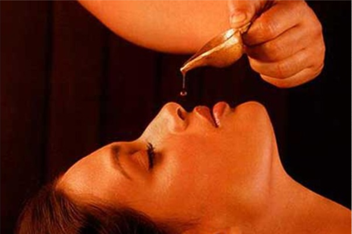 Ayurvedic Treatment for Sinusitis-br(Shirodhara, Nasya Karma & Pachakarma)